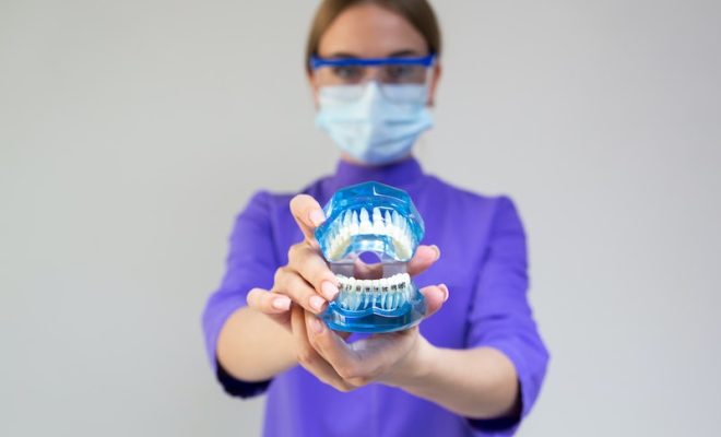 Top 6 Advantages of Wearing Braces