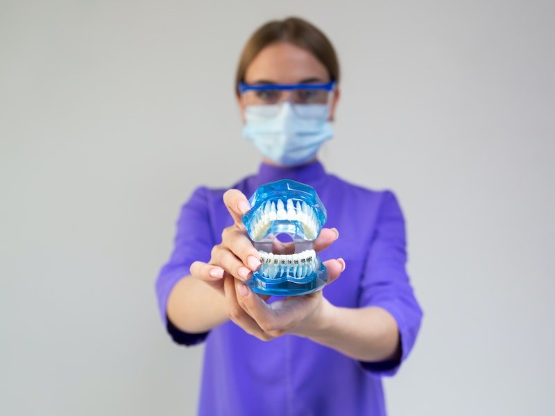 orthodontic braces