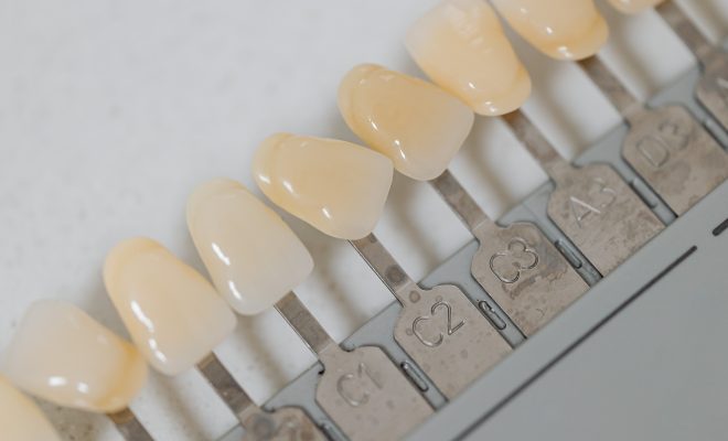 Getting Your Braces? Consider These 5 Preparation Tips