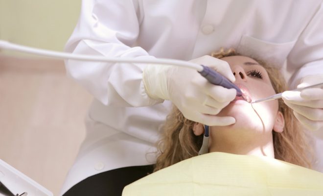 What Are the Benefits of Dental Veneers?