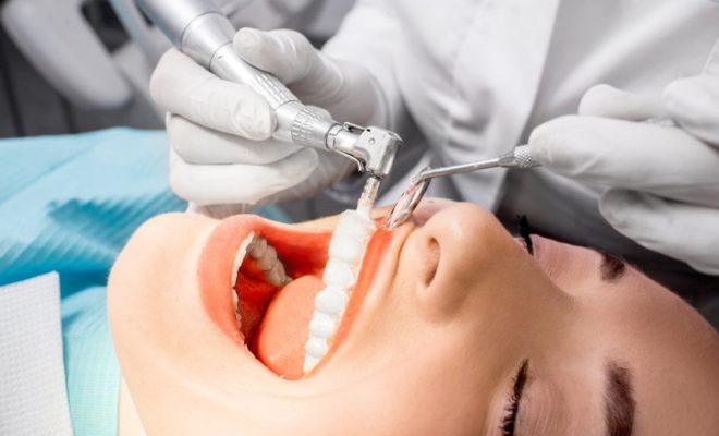Why Should I Get Professional Teeth Cleaning?