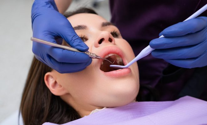 What Do Dental Implants Look Like After Surgery?